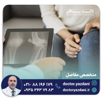 متخصص مفاصل